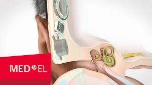 Ясан дамжуулалтын суулгац